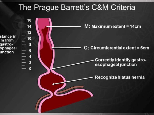 Slide9-2
