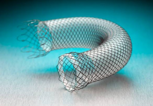 stent
