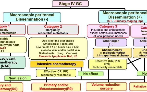 Gastric CA Stage 4